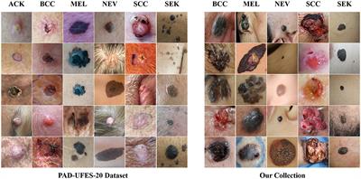 Classification of clinical skin lesions with double-branch networks